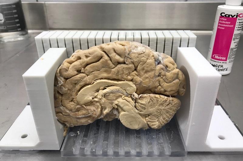 Brain Stand